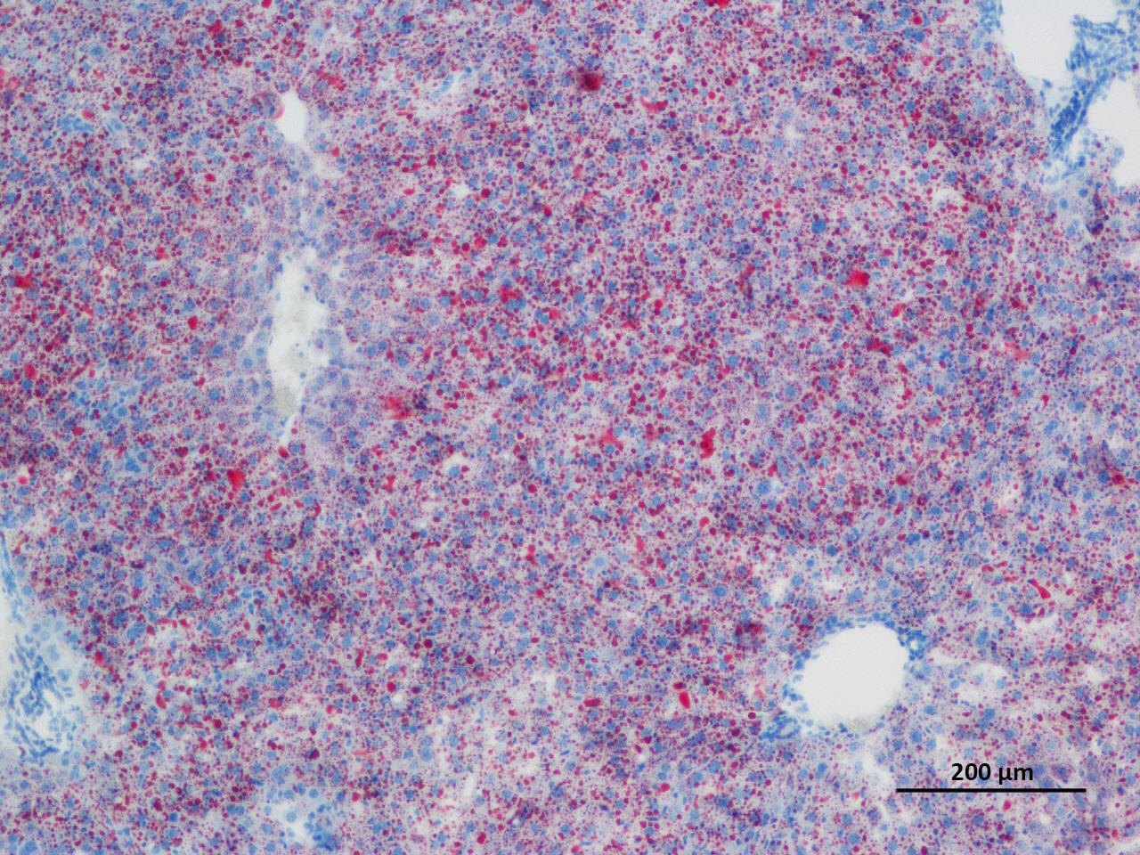 1684205704683649.jpg 肝PF4 油红 100-2.jpg